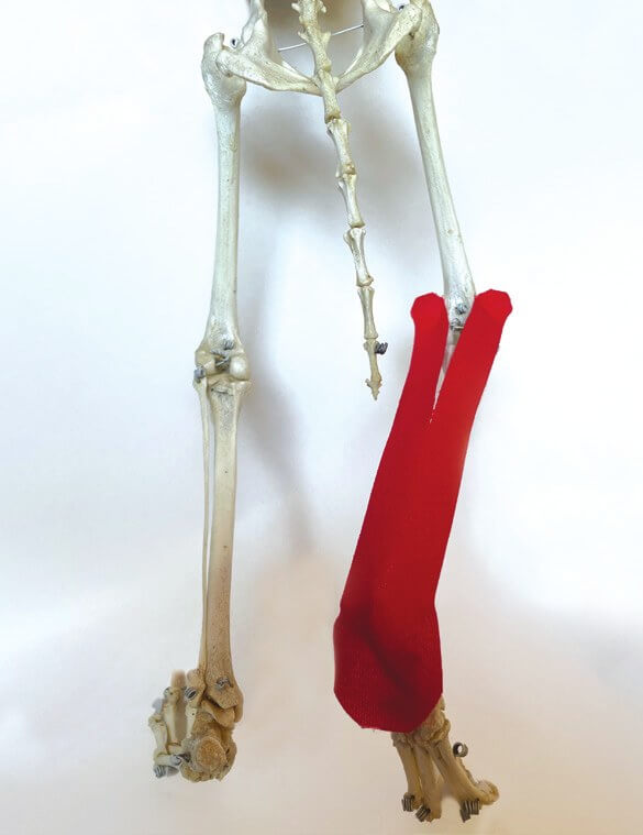 Tape position over the gastrocnemius muscle, shown on a skeleton