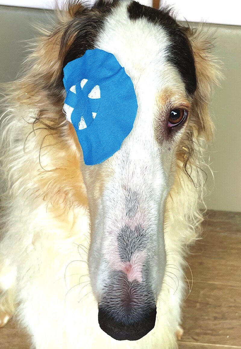 O shape tape applied to keep a bandage in place near the eye