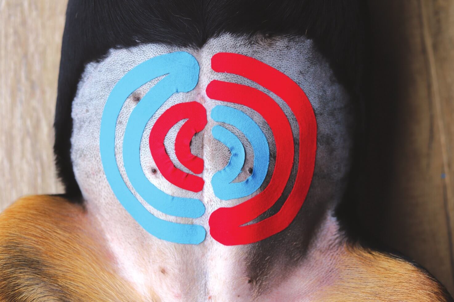 Spiral technique combining Y-shaped kinesiology tape cuts