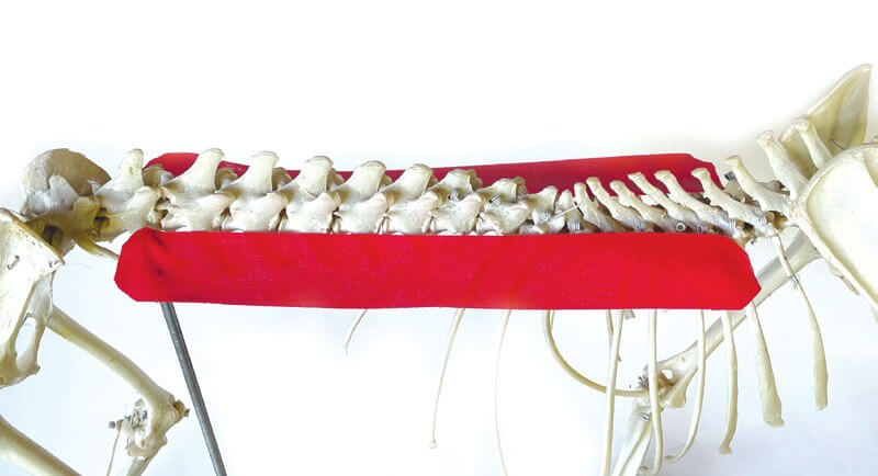 Tape-Position über dem Erector-spinae-Muskel, am Skelett dargestellt