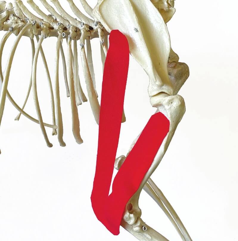 Tape-Position über dem Triceps-brachii-Muskel, am Skelett dargestellt