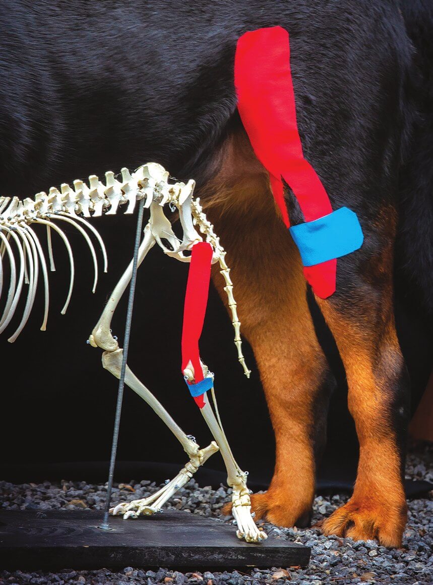 Y-förmiges Tape zur Aktivierung des Quadrizeps und Unterstützung der Patella