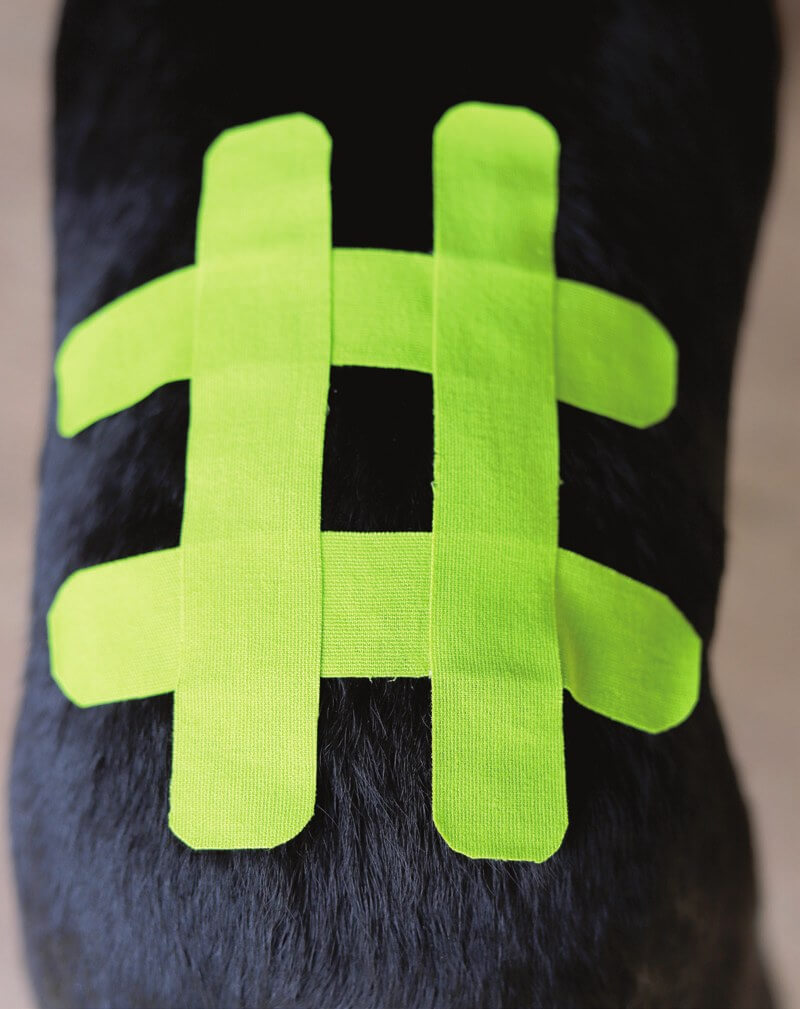 Hashtag-Technik mit mehreren I-förmigen Kinesio-Tape-Schnitten